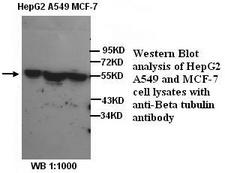 TUBB / Beta Tubulin Antibody