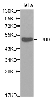 TUBB / Beta Tubulin Antibody - Western blot analysis of extracts of HeLa cells, using TUBB antibody. The secondary antibody used was an HRP Goat Anti-Rabbit IgG (H+L) at 1:10000 dilution. Lysates were loaded 25ug per lane and 3% nonfat dry milk in TBST was used for blocking.