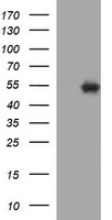 TUBB1 / Tubulin Beta 1 Antibody - HEK293T cells were transfected with the pCMV6-ENTRY control (Left lane) or pCMV6-ENTRY TUBB1 (Right lane) cDNA for 48 hrs and lysed. Equivalent amounts of cell lysates (5 ug per lane) were separated by SDS-PAGE and immunoblotted with anti-TUBB1.