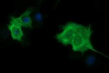TUBB1 / Tubulin Beta 1 Antibody - Anti-TUBB1 mouse monoclonal antibody immunofluorescent staining of COS7 cells transiently transfected by pCMV6-ENTRY TUBB1.