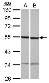 TUBB1 / Tubulin Beta 1 Antibody - Sample (30 ug of whole cell lysate) A: NT2D1 B: U87-MG 10% SDS PAGE TUBB1 antibody diluted at 1:10000