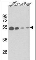 TUBB1 / Tubulin Beta 1 Antibody - Western blot of anti-TBB1 Antibody in mouse brain tissue, Y79, CEM and 293 lysates (35 ug/lane). TBB1 (arrow) was detected using the purified antibody.(1 ug/ml)