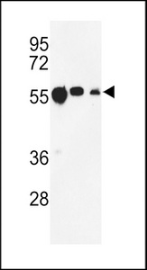 TUBB1 / Tubulin Beta 1 Antibody - Western blot of TBB1 Antibody in CEM, MCF-7, MDA-MB231 cell line lysates (35 ug/lane). TBB1 (arrow) was detected using the purified antibody.