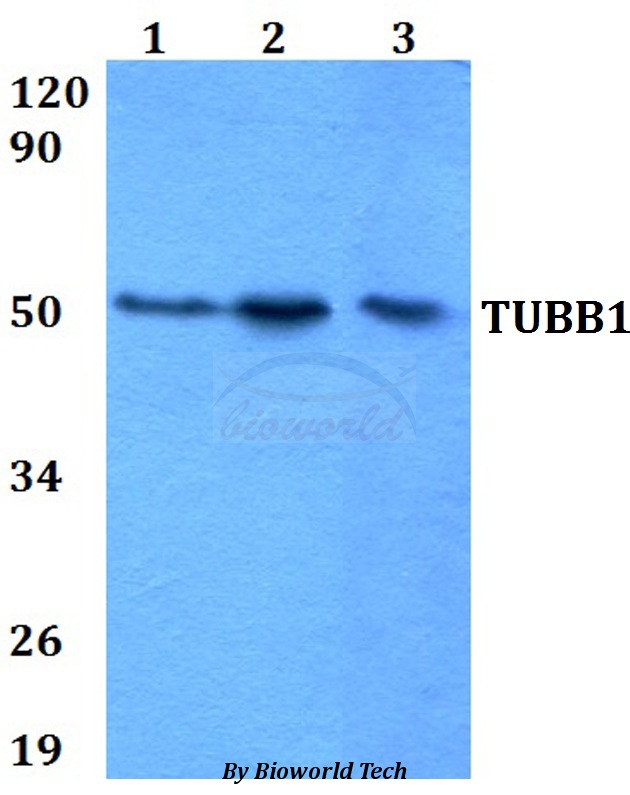 TUBB1 / Tubulin Beta 1 Antibody - Western blot of TUBB1 antibody at 1:500 dilution. Lane 1: HEK293Twhole cell lysate. Lane 2: Raw264.7 whole cell lysate. Lane 3: PC12 whole cell lysate.