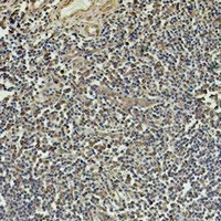 TUBB1 / Tubulin Beta 1 Antibody - Immunohistochemical analysis of Beta1-tubulin staining in human tonsil formalin fixed paraffin embedded tissue section. The section was pre-treated using heat mediated antigen retrieval with sodium citrate buffer (pH 6.0). The section was then incubated with the antibody at room temperature and detected using an HRP conjugated compact polymer system. DAB was used as the chromogen. The section was then counterstained with hematoxylin and mounted with DPX.