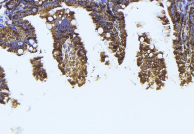 TUBB1 / Tubulin Beta 1 Antibody - 1:100 staining mouse colon tissue by IHC-P. The sample was formaldehyde fixed and a heat mediated antigen retrieval step in citrate buffer was performed. The sample was then blocked and incubated with the antibody for 1.5 hours at 22°C. An HRP conjugated goat anti-rabbit antibody was used as the secondary.