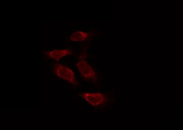 TUBB1 / Tubulin Beta 1 Antibody - Staining HeLa cells by IF/ICC. The samples were fixed with PFA and permeabilized in 0.1% Triton X-100, then blocked in 10% serum for 45 min at 25°C. The primary antibody was diluted at 1:200 and incubated with the sample for 1 hour at 37°C. An Alexa Fluor 594 conjugated goat anti-rabbit IgG (H+L) Ab, diluted at 1/600, was used as the secondary antibody.