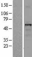 TUBB1 / Tubulin Beta 1 Protein - Western validation with an anti-DDK antibody * L: Control HEK293 lysate R: Over-expression lysate