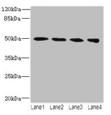 TUBB2A / Tubulin Beta 2A Antibody - Western blot All lanes: Tubulin beta-2A chain antibody at 14µg/ml Lane 1: MCF-7 whole cell lysate Lane 2: Hela whole cell lysate Lane 3: HepG2 whole cell lysate Lane 4: MDA-MB-231 whole cell lysate Secondary Goat polyclonal to rabbit IgG at 1/10000 dilution Predicted band size: 50 kDa Observed band size: 50 kDa