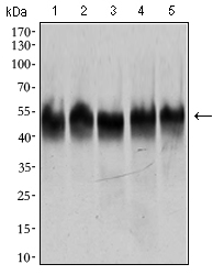 TUBB2A / Tubulin Beta 2A Antibody - Western blot using TUBB2A mouse monoclonal antibody against HeLa (1), A549 (2), HEK293 (3), Jurkat (4) and PC-12 (5) cell lysate.