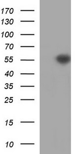 TUBB2A / Tubulin Beta 2A Antibody - HEK293T cells were transfected with the pCMV6-ENTRY control (Left lane) or pCMV6-ENTRY TUBB2A (Right lane) cDNA for 48 hrs and lysed. Equivalent amounts of cell lysates (5 ug per lane) were separated by SDS-PAGE and immunoblotted with anti-TUBB2A.