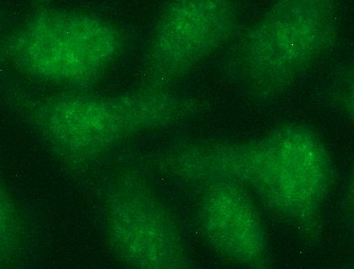 TUBB2A / Tubulin Beta 2A Antibody - Immunofluorescent staining of HeLa cells using anti-TUBB2A mouse monoclonal antibody.