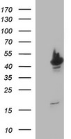TUBB2A / Tubulin Beta 2A Antibody - HEK293T cells were transfected with the pCMV6-ENTRY control (Left lane) or pCMV6-ENTRY TUBB2A (Right lane) cDNA for 48 hrs and lysed. Equivalent amounts of cell lysates (5 ug per lane) were separated by SDS-PAGE and immunoblotted with anti-TUBB2A.