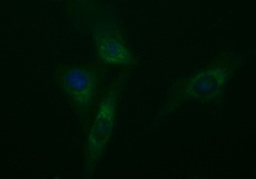 TUBB2A / Tubulin Beta 2A Antibody - Immunofluorescent staining of HeLa cells using anti-TUBB2A mouse monoclonal antibody.