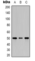 TUBB2A / Tubulin Beta 2A Antibody - Western blot analysis of Beta2A-tubulin expression in HeLa (A); NIH3T3 (B); rat kidney (C) whole cell lysates.