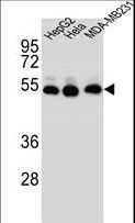 TUBB2B / Tubulin Beta 2B Antibody - TUBB2B Antibody western blot of HepG2,HeLa,MDA-MB231 cell line lysates (35 ug/lane). The TUBB2B antibody detected the TUBB2B protein (arrow).