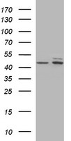 TUBB2B / Tubulin Beta 2B Antibody - HEK293T cells were transfected with the pCMV6-ENTRY control (Left lane) or pCMV6-ENTRY TUBB2B (Right lane) cDNA for 48 hrs and lysed. Equivalent amounts of cell lysates (5 ug per lane) were separated by SDS-PAGE and immunoblotted with anti-TUBB2B.