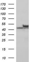 TUBB2B / Tubulin Beta 2B Antibody - HEK293T cells were transfected with the pCMV6-ENTRY control (Left lane) or pCMV6-ENTRY TUBB2B (Right lane) cDNA for 48 hrs and lysed. Equivalent amounts of cell lysates (5 ug per lane) were separated by SDS-PAGE and immunoblotted with anti-TUBB2B.