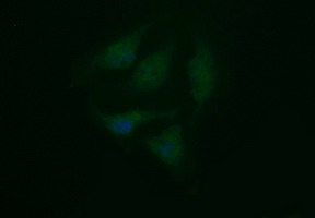 TUBB2B / Tubulin Beta 2B Antibody - Immunofluorescent staining of HeLa cells using anti-TUBB2B mouse monoclonal antibody.