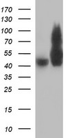TUBB2B / Tubulin Beta 2B Antibody - HEK293T cells were transfected with the pCMV6-ENTRY control (Left lane) or pCMV6-ENTRY TUBB2B (Right lane) cDNA for 48 hrs and lysed. Equivalent amounts of cell lysates (5 ug per lane) were separated by SDS-PAGE and immunoblotted with anti-TUBB2B.