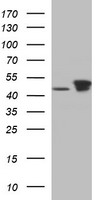 TUBB2B / Tubulin Beta 2B Antibody - HEK293T cells were transfected with the pCMV6-ENTRY control (Left lane) or pCMV6-ENTRY TUBB2B (Right lane) cDNA for 48 hrs and lysed. Equivalent amounts of cell lysates (5 ug per lane) were separated by SDS-PAGE and immunoblotted with anti-TUBB2B.