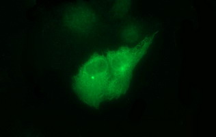 TUBB2B / Tubulin Beta 2B Antibody - Anti-TUBB2B mouse monoclonal antibody immunofluorescent staining of COS7 cells transiently transfected by pCMV6-ENTRY TUBB2B.