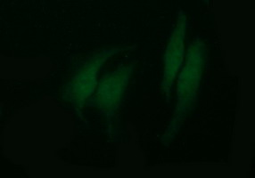 TUBB2B / Tubulin Beta 2B Antibody - Immunofluorescent staining of HeLa cells using anti-TUBB2B mouse monoclonal antibody.