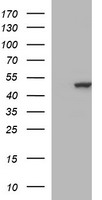 TUBB2B / Tubulin Beta 2B Antibody - HEK293T cells were transfected with the pCMV6-ENTRY control (Left lane) or pCMV6-ENTRY TUBB2B (Right lane) cDNA for 48 hrs and lysed. Equivalent amounts of cell lysates (5 ug per lane) were separated by SDS-PAGE and immunoblotted with anti-TUBB2B.