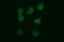 TUBB2B / Tubulin Beta 2B Antibody - Anti-TUBB2B mouse monoclonal antibody immunofluorescent staining of COS7 cells transiently transfected by pCMV6-ENTRY TUBB2B.