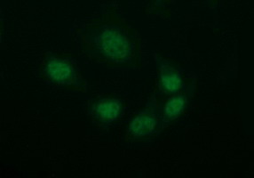 TUBB2B / Tubulin Beta 2B Antibody - Immunofluorescent staining of HeLa cells using anti-TUBB2B mouse monoclonal antibody.