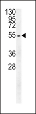 TUBB3 / Tubulin Beta 3 Antibody - TUBB3 Antibody western blot of HepG2 cell line lysates (15 ug/lane). The TUBB3 antibody detected the TUBB3 protein (arrow).