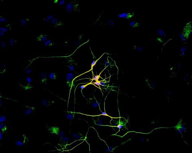 TUBB3 / Tubulin Beta 3 Antibody - beta-3 Tubulin Antibody in Immunofluorescence (IF)