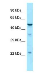 TUBB3 / Tubulin Beta 3 Antibody - TUBB3 / Tubulin Beta 3 antibody Western Blot of Fetal Brain.  This image was taken for the unconjugated form of this product. Other forms have not been tested.