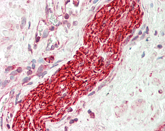 TUBB3 / Tubulin Beta 3 Antibody - Human Prostate, Nerve: Formalin-Fixed, Paraffin-Embedded (FFPE).  This image was taken for the unconjugated form of this product. Other forms have not been tested.