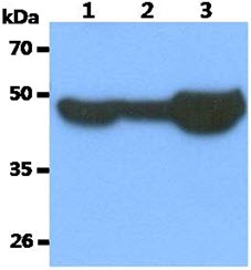 TUBB3 / Tubulin Beta 3 Antibody - The Cell lysates (40ug) and Mouse tissue extract (40ug) were resolved by SDS-PAGE, transferred to PVDF membrane and probed with anti-human Tubulin Beta 3 antibody (1:1000). Proteins were visualized using a goat anti-mouse secondary antibody conjugated to HRP and an ECL detection system. Lane 1.: HeLa cell lysate Lane 2.: 293T cell lysate Lane 3.: Mouse Brain tissue extract