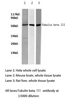 TUBB3 / Tubulin Beta 3 Antibody - Western blot of Tubulin beta III pAb in extracts from HeLa cells, mouse brain and Rat liver tissues.