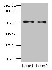 TUBB3 / Tubulin Beta 3 Antibody - Western blot All lanes: TUBB3 antibody at 6µg/ml Lane 1: A549 whole cell lysate Lane 2: A431 whole cell lysate Secondary Goat polyclonal to rabbit IgG at 1/10000 dilution Predicted band size: 51, 43 kDa Observed band size: 51 kDa