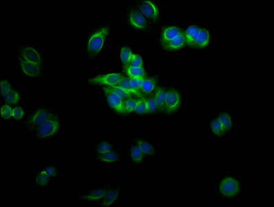 TUBB3 / Tubulin Beta 3 Antibody