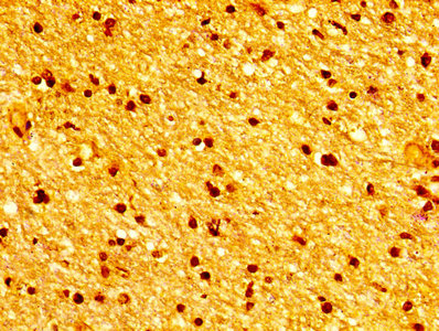 TUBB3 / Tubulin Beta 3 Antibody - Immunohistochemistry of paraffin-embedded human brain tissue using TUBB3 Antibody at dilution of 1:100