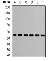 TUBB3 / Tubulin Beta 3 Antibody - Western blot analysis of Beta-tubulin expression in A549 (A); mouse brain (B); rat brain (C); chicken lung (D); rabbit testis (E); sheep muscle (F) whole cell lysates.