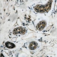 TUBB3 / Tubulin Beta 3 Antibody - Immunohistochemical analysis of Beta-tubulin staining in human colon formalin fixed paraffin embedded tissue section. The section was pre-treated using heat mediated antigen retrieval with sodium citrate buffer (pH 6.0). The section was then incubated with the antibody at room temperature and detected using an HRP conjugated compact polymer system. DAB was used as the chromogen. The section was then counterstained with hematoxylin and mounted with DPX.