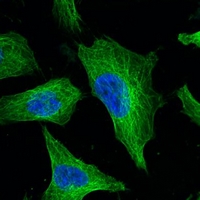 TUBB3 / Tubulin Beta 3 Antibody - Immunofluorescent analysis of Beta-tubulin staining in HeLa cells. Formalin-fixed cells were permeabilized with 0.1% Triton X-100 in TBS for 5-10 minutes and blocked with 3% BSA-PBS for 30 minutes at room temperature. Cells were probed with the primary antibody in 3% BSA-PBS and incubated overnight at 4 deg C in a humidified chamber. Cells were washed with PBST and incubated with a FITC-conjugated secondary antibody (green) in PBS at room temperature in the dark. DAPI was used to stain the cell nuclei (blue).