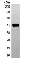 TUBB3 / Tubulin Beta 3 Antibody - Immunoprecipitation of Beta-tubulin from 0.5mg mouse brain whole cell extract lysate; using Anti-Beta-tubulin Antibody.