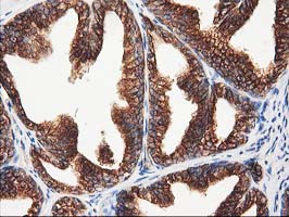 TUBB4 / Tubulin Beta 4 Antibody - IHC of paraffin-embedded Human prostate tissue using anti-TUBB4 mouse monoclonal antibody.