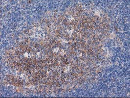 TUBB4 / Tubulin Beta 4 Antibody - IHC of paraffin-embedded Human lymph node tissue using anti-TUBB4 mouse monoclonal antibody.