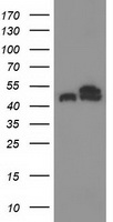 TUBB4 / Tubulin Beta 4 Antibody - HEK293T cells were transfected with the pCMV6-ENTRY control (Left lane) or pCMV6-ENTRY TUBB4 (Right lane) cDNA for 48 hrs and lysed. Equivalent amounts of cell lysates (5 ug per lane) were separated by SDS-PAGE and immunoblotted with anti-TUBB4.