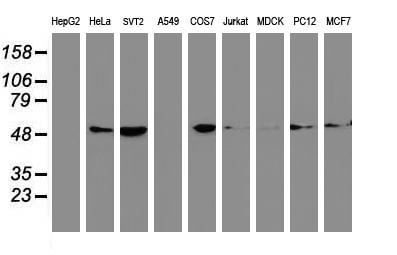 TUBB4 / Tubulin Beta 4 Antibody - Western blot of extracts (35 ug) from 9 different cell lines by using anti-TUBB4 monoclonal antibody.