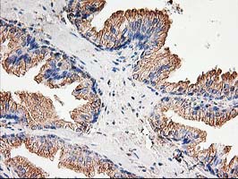 TUBB4 / Tubulin Beta 4 Antibody - IHC of paraffin-embedded Human prostate tissue using anti-TUBB4 mouse monoclonal antibody.