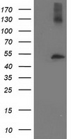 TUBB4 / Tubulin Beta 4 Antibody - HEK293T cells were transfected with the pCMV6-ENTRY control (Left lane) or pCMV6-ENTRY TUBB4 (Right lane) cDNA for 48 hrs and lysed. Equivalent amounts of cell lysates (5 ug per lane) were separated by SDS-PAGE and immunoblotted with anti-TUBB4.