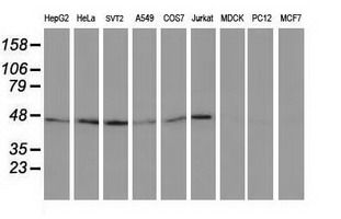 TUBB4 / Tubulin Beta 4 Antibody - Western blot of extracts (35 ug) from 9 different cell lines by using anti-TUBB4 monoclonal antibody.
